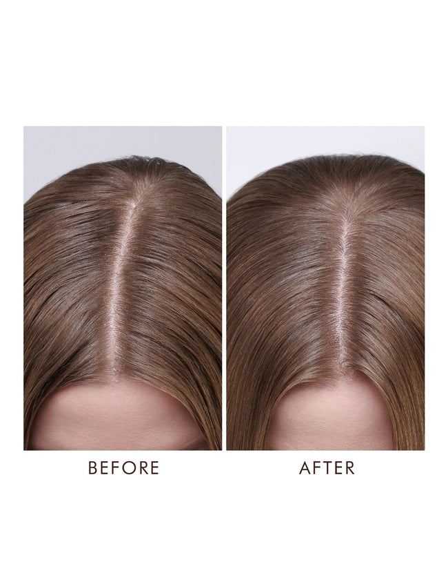 MOROCCAN OIL - DRY SCALP TREATMENT | 100mls