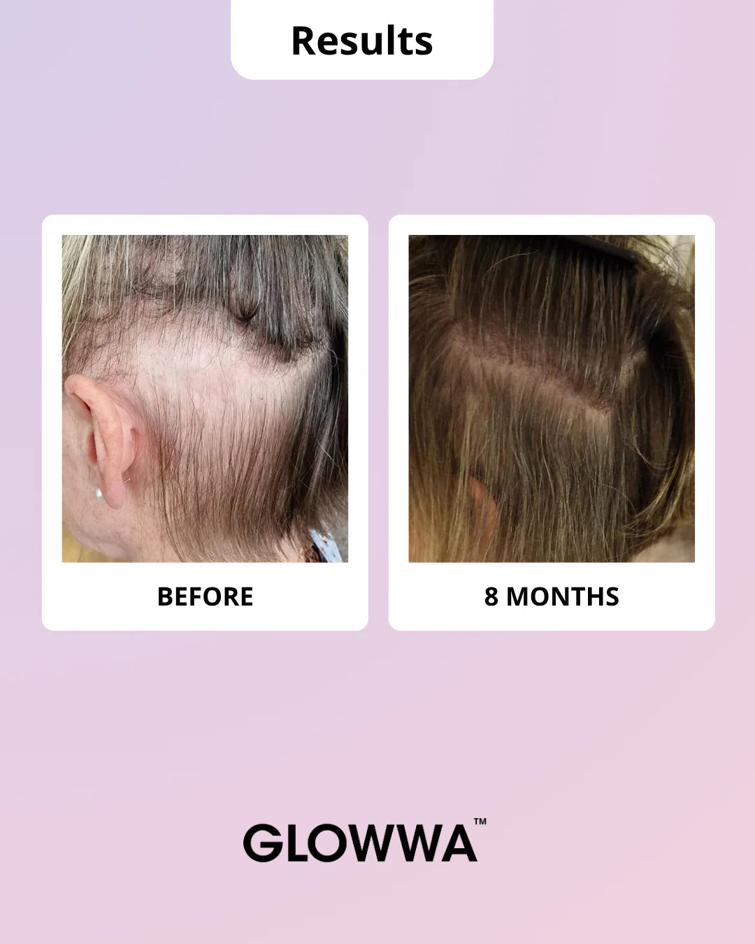 Glowwa hair food - Meno 3month supply