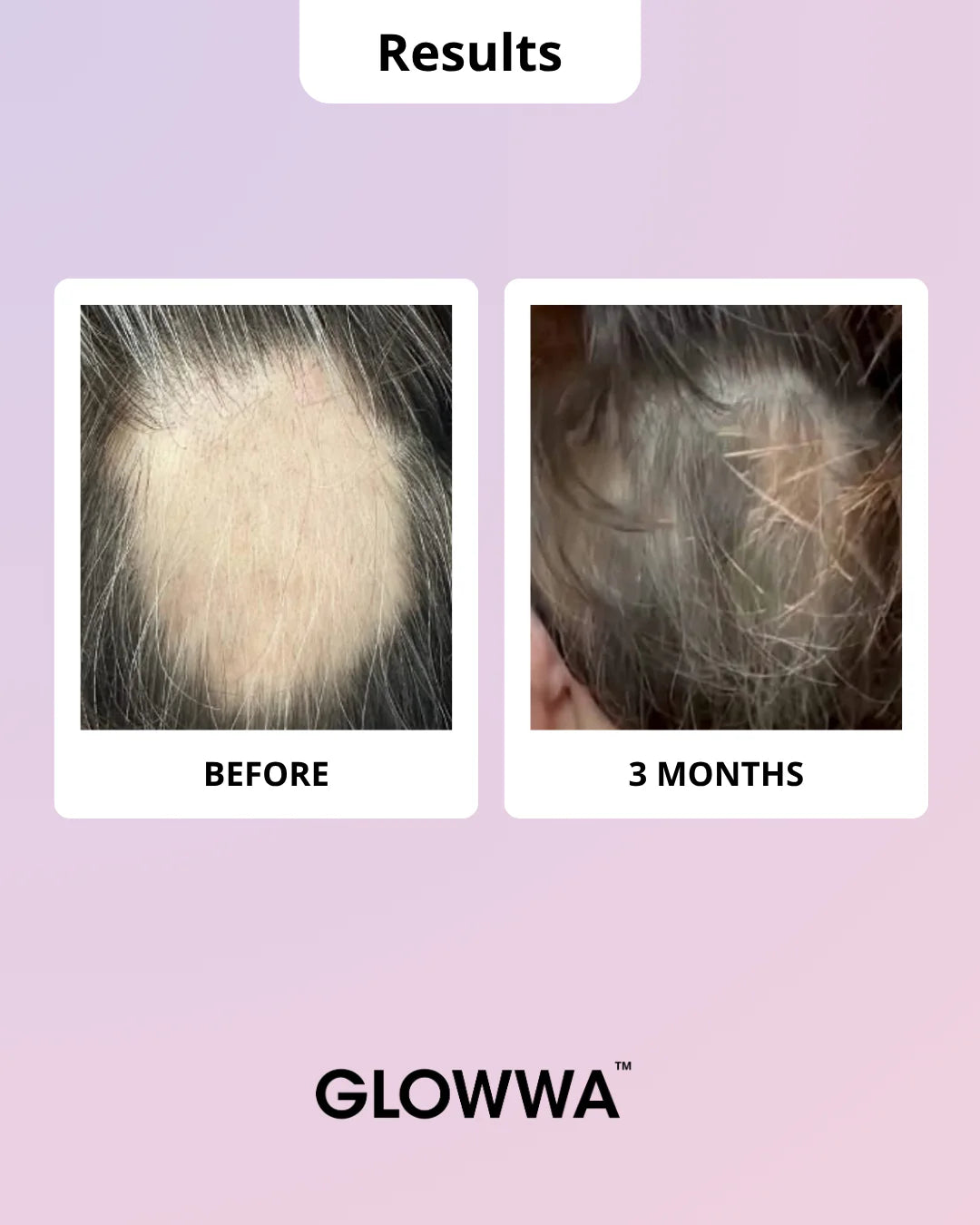 Glowwa hair food - Meno 3month supply