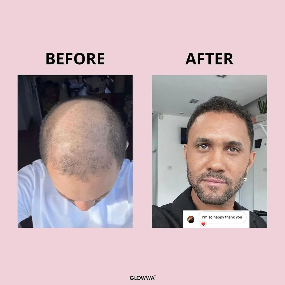 Glowwa hair food - original