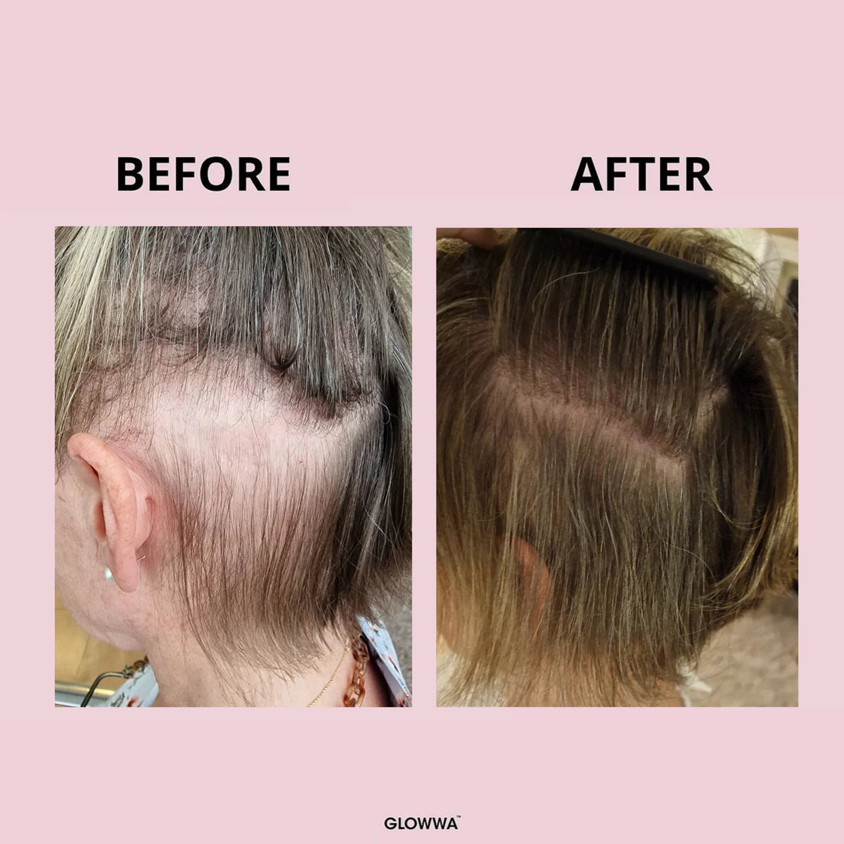 Glowwa hair food - original