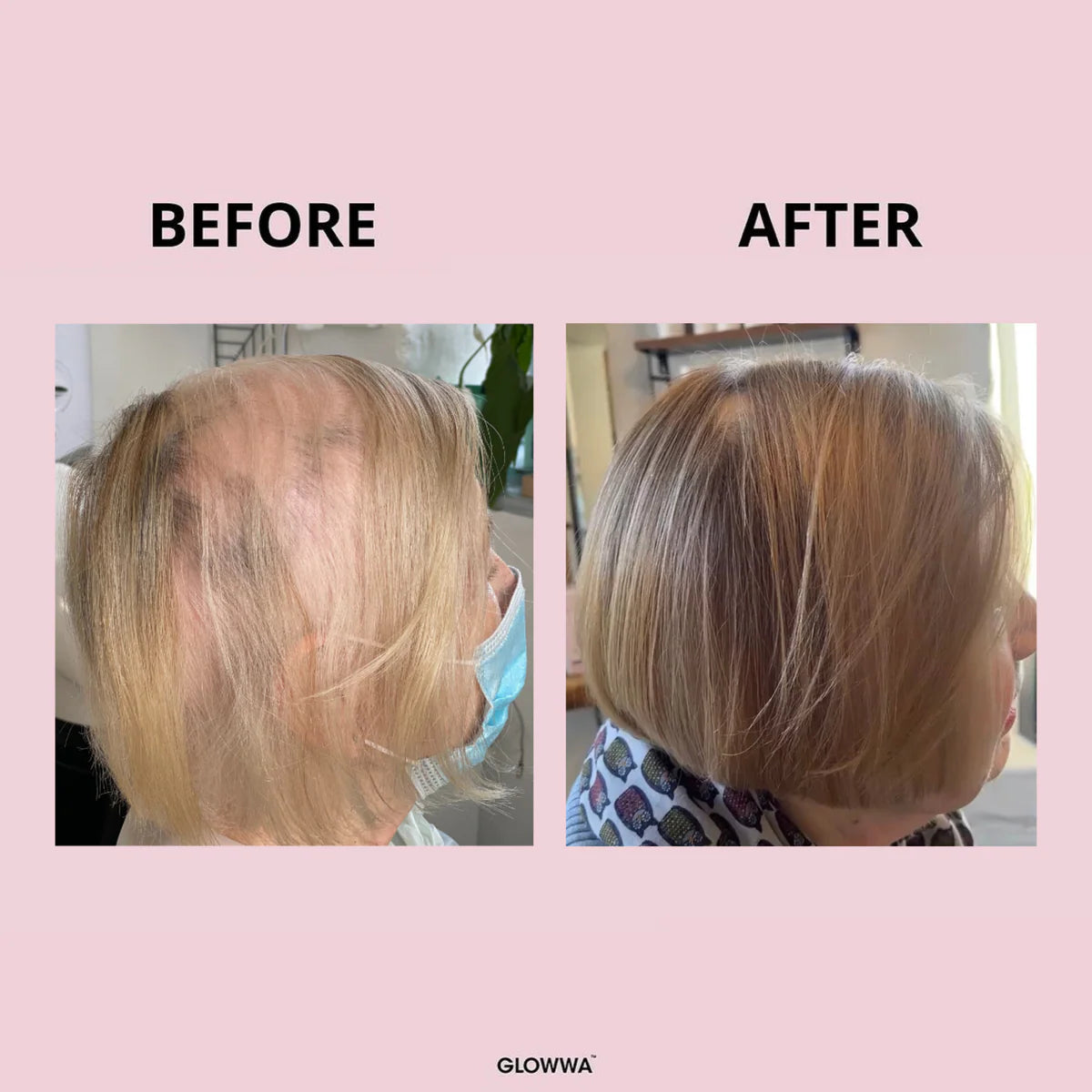 Glowwa hair food - original trio