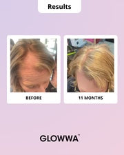 Glowwa hair food - meno